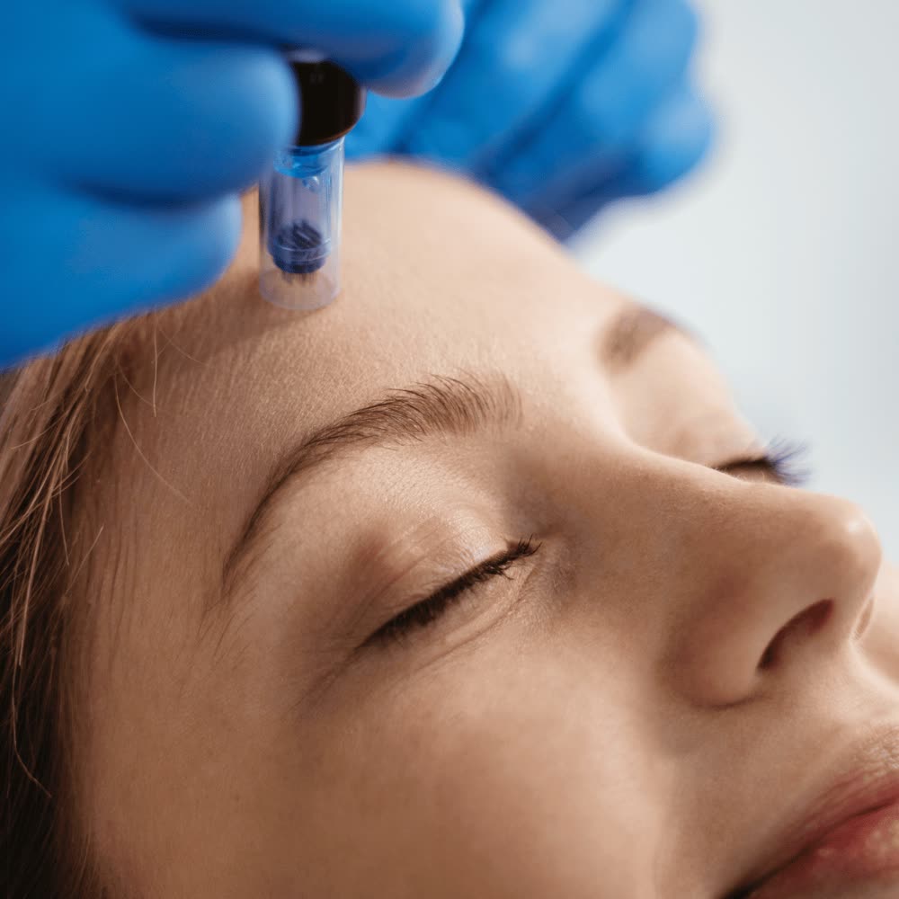 HydraFacial-behandling af ansigtet